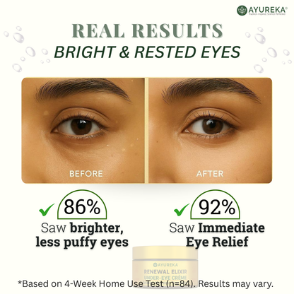 Advanced Under-Eye Creme for Dark Circles, Puffiness, Fine Lines & Brightening (50g)